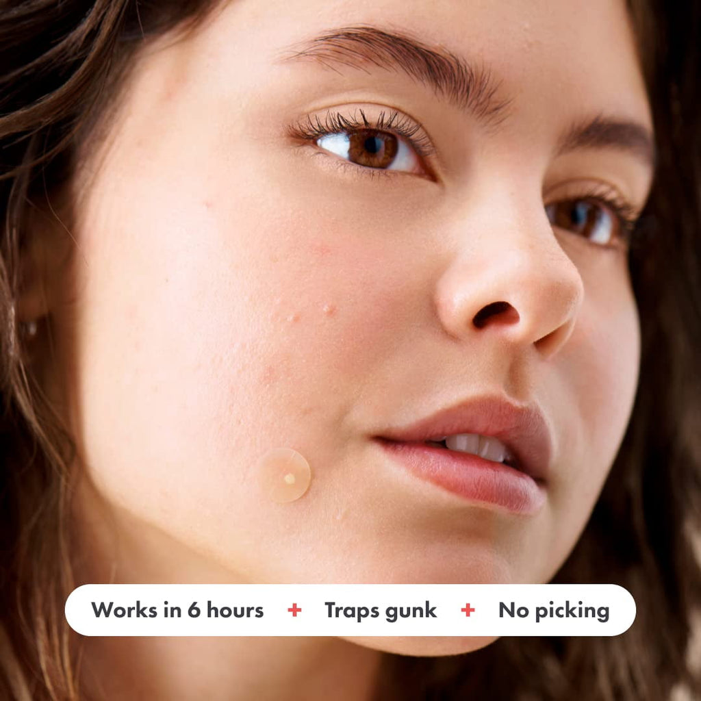 Mighty Patch™ Original from Hero Cosmetics - Hydrocolloid Acne Pimple Patch (27 Patches)